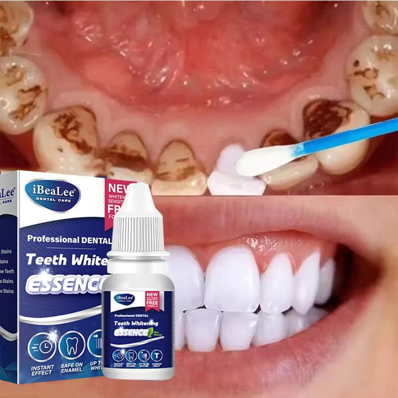 Teeth Whitening Serum - Эссенция для отбеливания зубов, сыворотка для