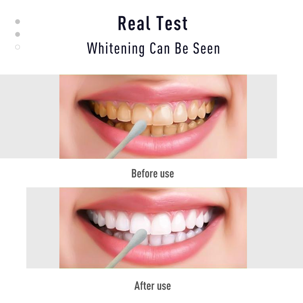 Гель для зубов в виде ручки, б – обзор и цена Whitening Pen Bleach