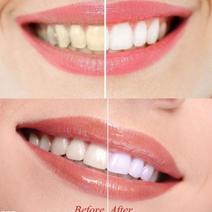 Бамбуковый уголь для зубов, ст – обзор и цена Teeth Whitening Zimba