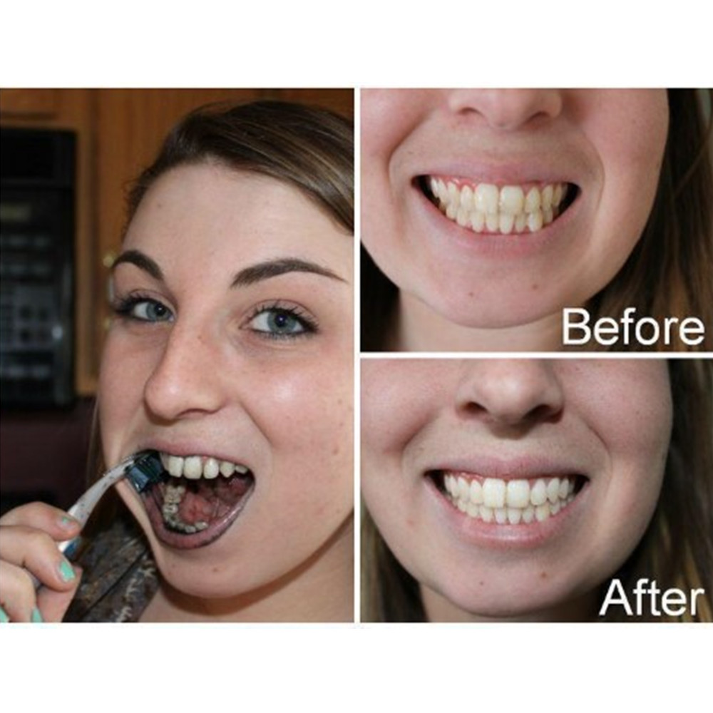 Бамбуковый уголь для зубов, ст – обзор и цена Teeth Whitening Zimba