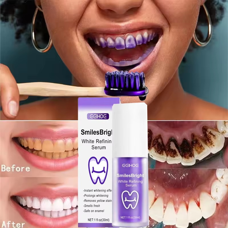 Отбеливающая зубная паста-гель – обзор и цена Teeth Whitening Korea
