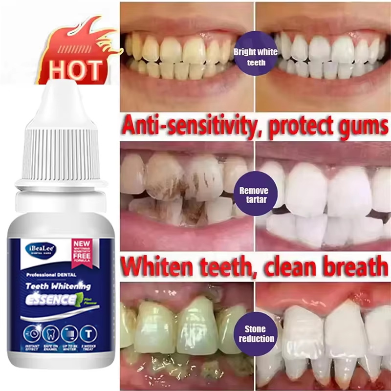 Эссенция для отбеливания зубов – обзор и цена Teeth Whitening Serum