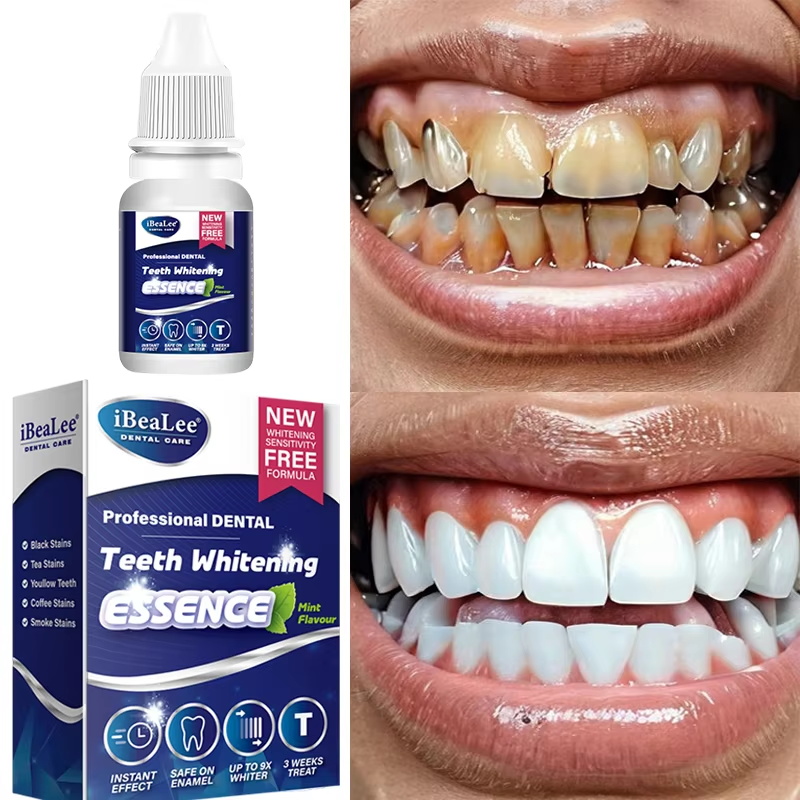 Эссенция для отбеливания зубов – обзор и цена Teeth Whitening Serum