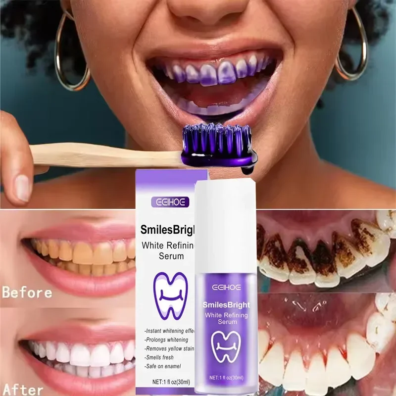 Очищение зубов, отбеливающая з – обзор и цена Teeth Whitening Korea