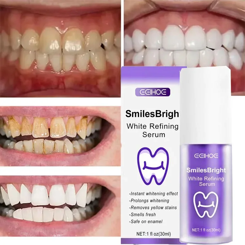 Очищение зубов, отбеливающая з – обзор и цена Teeth Whitening Korea