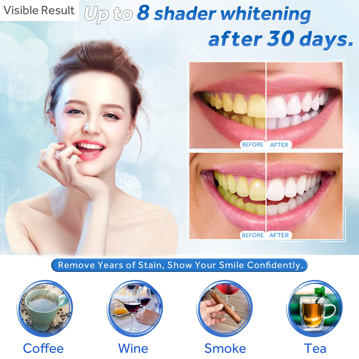 Гель для отбеливания зубов, шп – обзор и цена Teeth Whitening With Peroxide