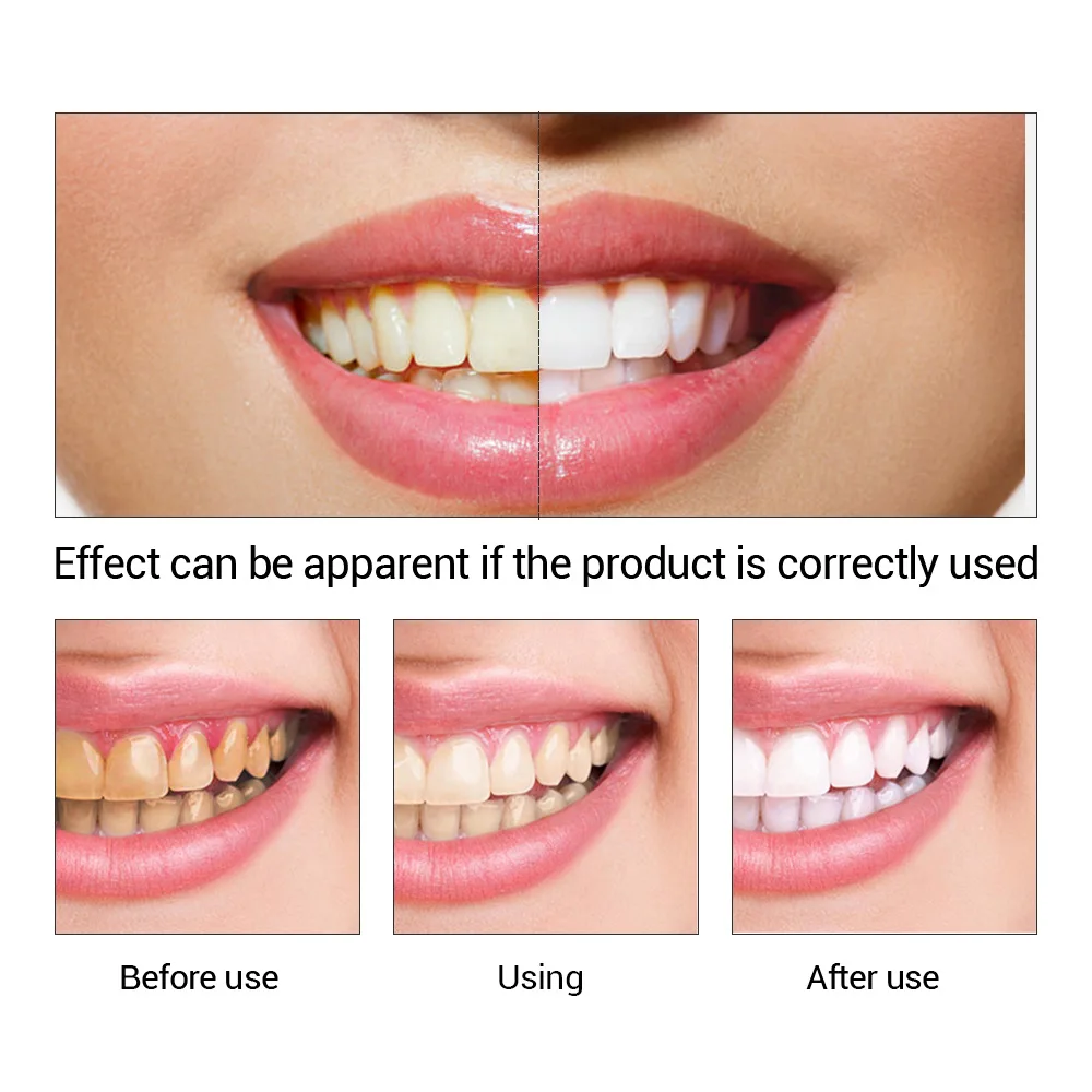 FTEENPLY отбеливание зубов быс – обзор и цена Teeth Whitening Serum