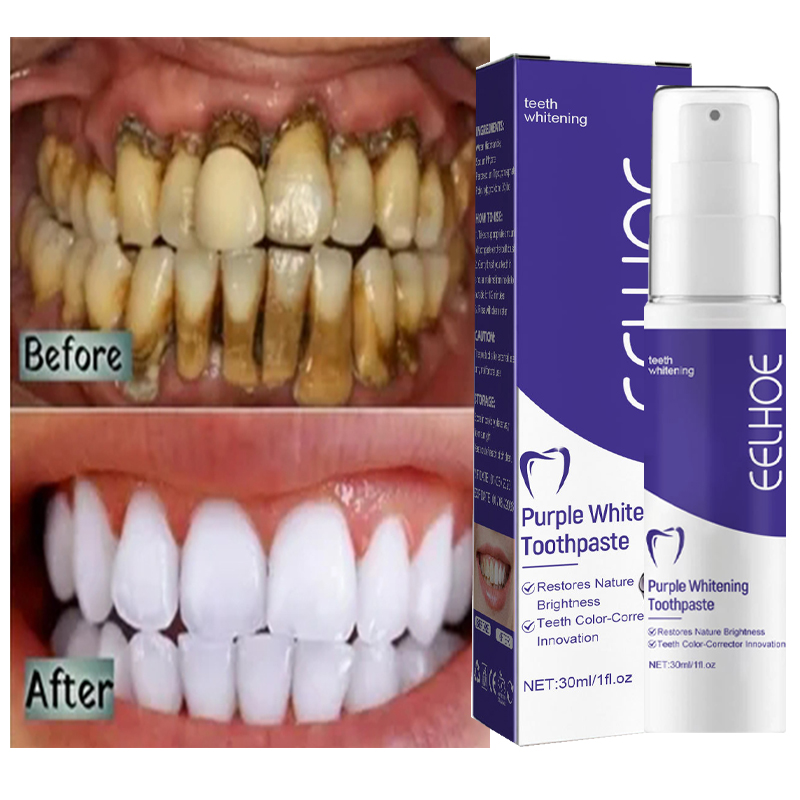 1 шт. зубная паста для Очищающ – обзор и цена Teeth Whitening Korea