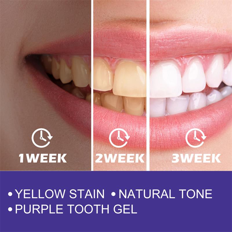 1 шт. зубная паста для Очищающ – обзор и цена Teeth Whitening Korea