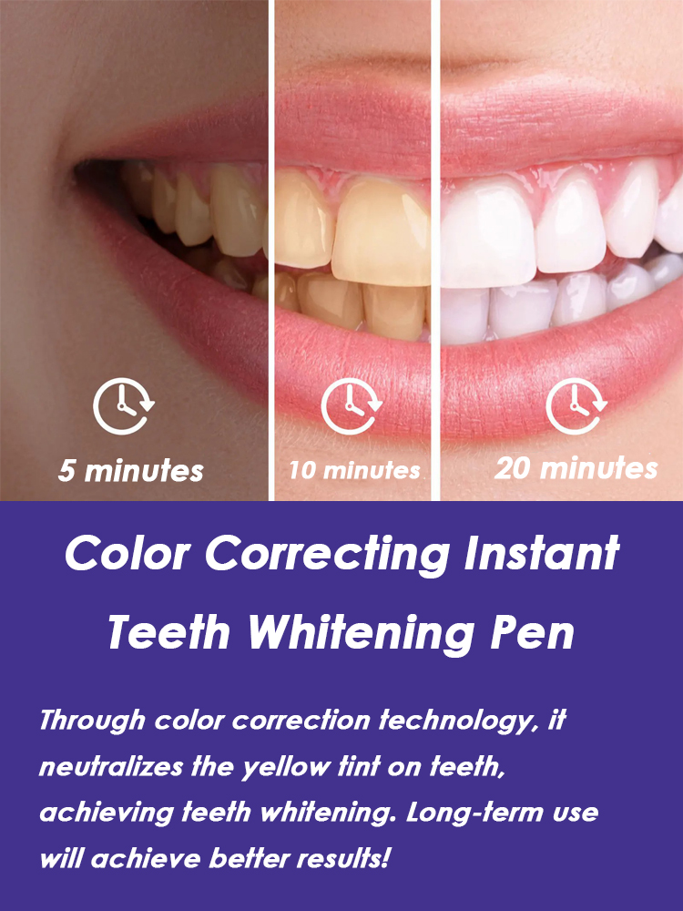 Ручка для отбеливания зубов, э – обзор и цена Whitening Pen Bleach