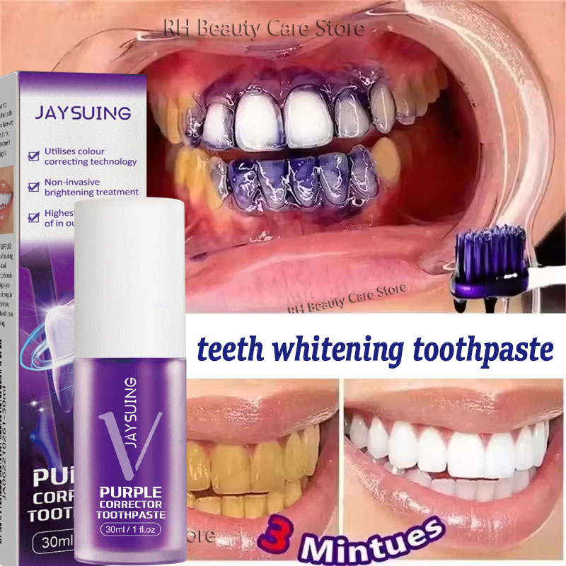 Отбеливающая зубная паста-гель – обзор и цена Teeth Whitening Korea