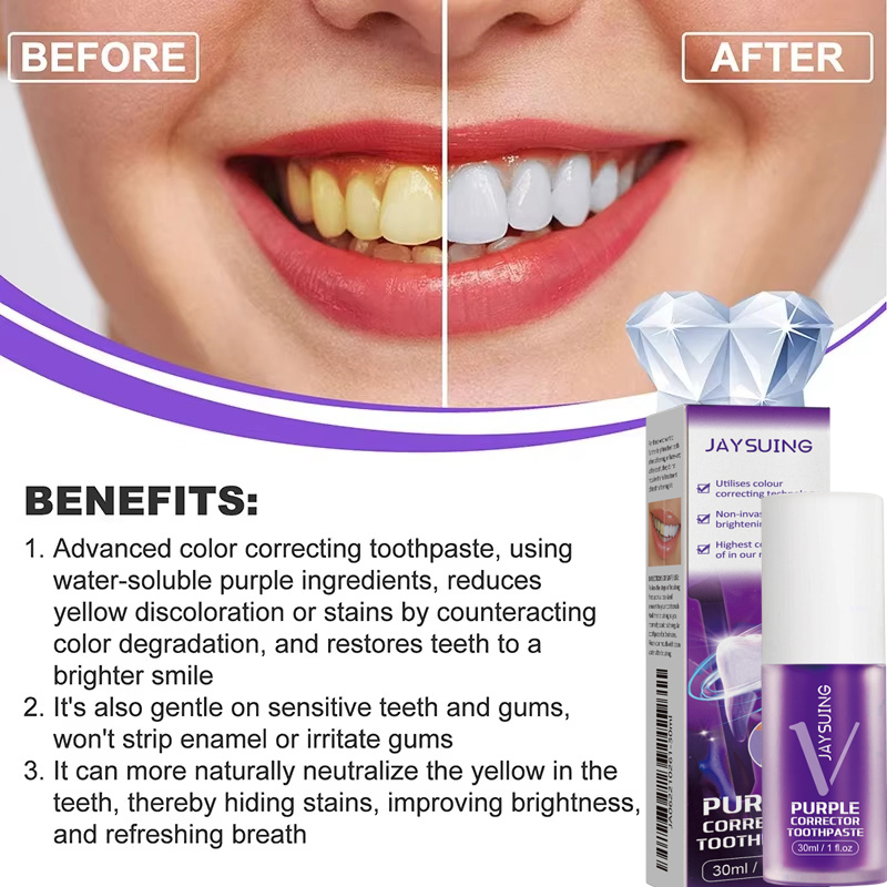Отбеливающая зубная паста-гель – обзор и цена Teeth Whitening Korea