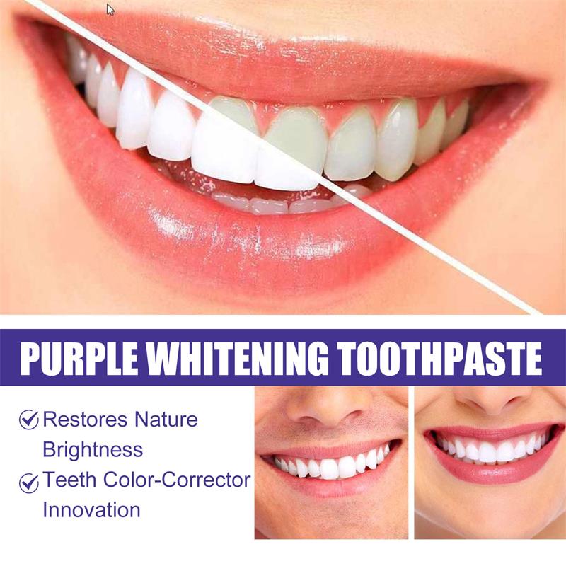 Отбеливающая зубная паста-гель – обзор и цена Teeth Whitening Korea