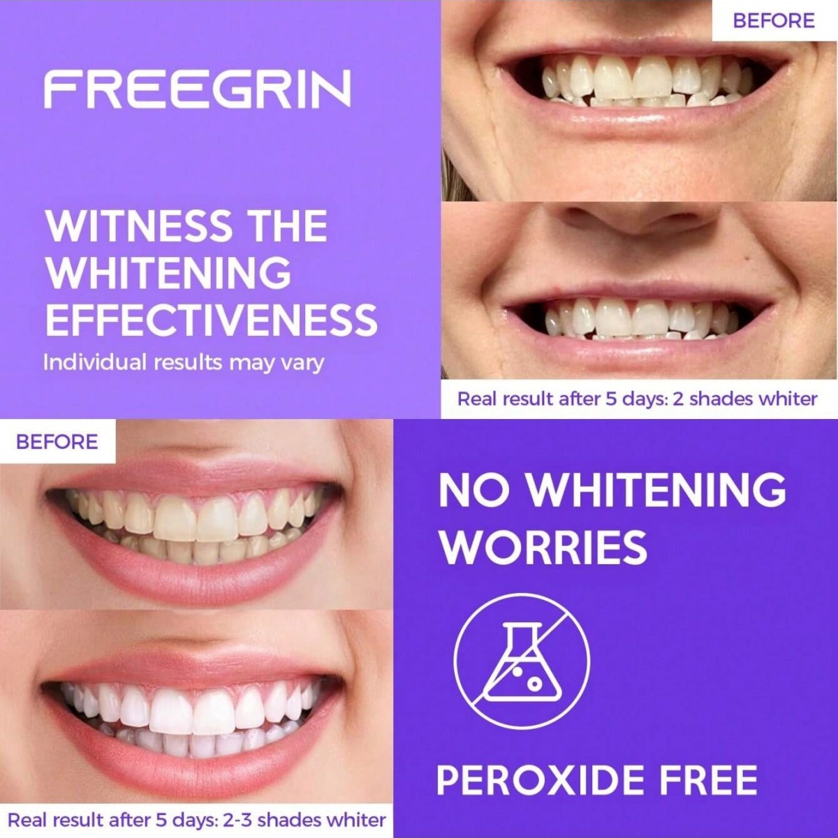 Роскошные отбеливающие наклейк – обзор и цена Teeth Whitening With Peroxide