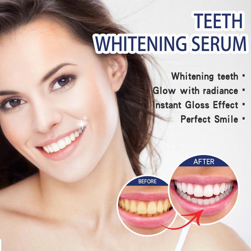 Профессиональная сыворотка для – обзор и цена Teeth Whitening Serum