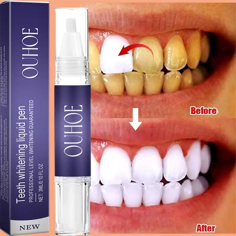 Зубная паста для быстрого отбе – обзор и цена Whitening Pen Bleach