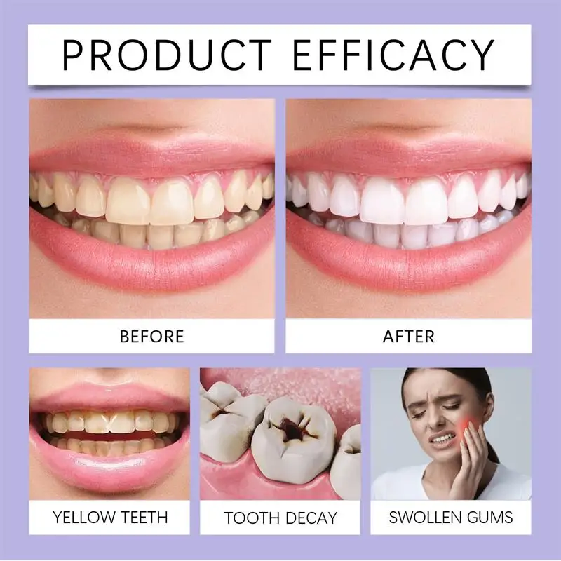 Зубная паста для быстрого отбе – обзор и цена Whitening Pen Bleach
